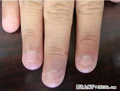 剪指甲、挖耳屎，这些日常小动作竟隐藏大危害！ - 大理生活资讯 - 大理28生活网 dali.28life.net